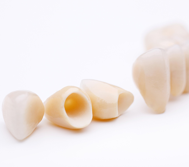 Phoenix Dental Crowns and Dental Bridges