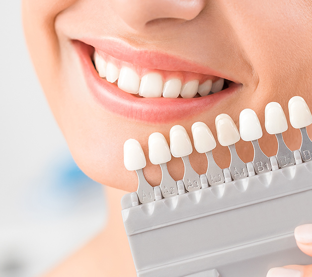 Phoenix Dental Veneers and Dental Laminates