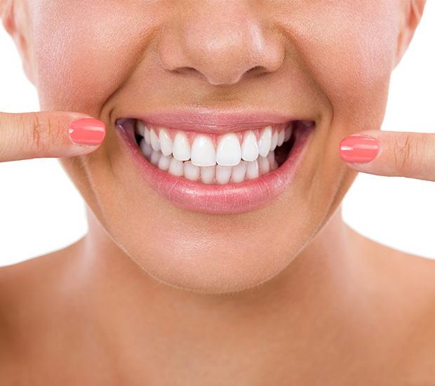 Phoenix What Is Gum Contouring and Reshaping