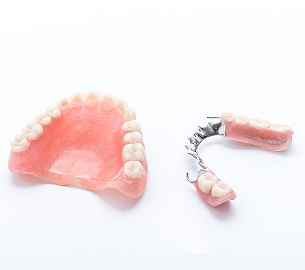 Phoenix Partial Dentures for Back Teeth