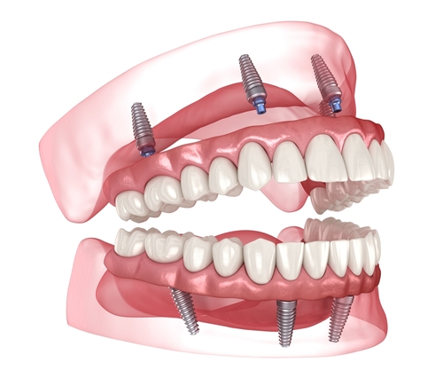Tatum Dental Care in Phoenix, AZ - Friendly staff and exceptional dental services for patients of all ages.