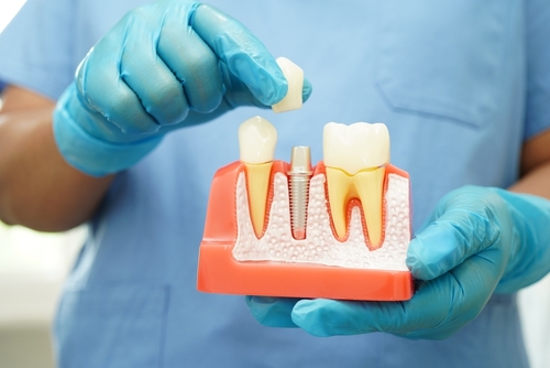 Tatum Dental Care in Phoenix, AZ - Friendly staff and exceptional dental services for patients of all ages.
